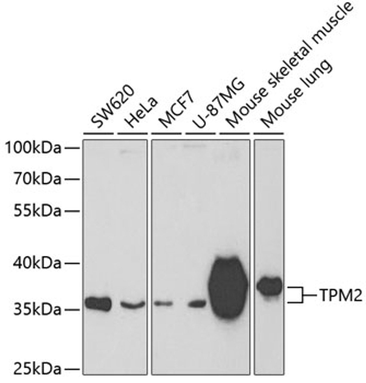 Western blot analysis of extracts of various cell lines, using TPM2 antibody (18-940) at 1:400 dilution.<br/>Secondary antibody: HRP Goat Anti-Rabbit IgG (H+L) at 1:10000 dilution.<br/>Lysates/proteins: 25ug per lane.<br/>Blocking buffer: 3% nonfat dry milk in TBST.<br/>Detection: ECL Basic Kit.<br/>Exposure time: 90s.