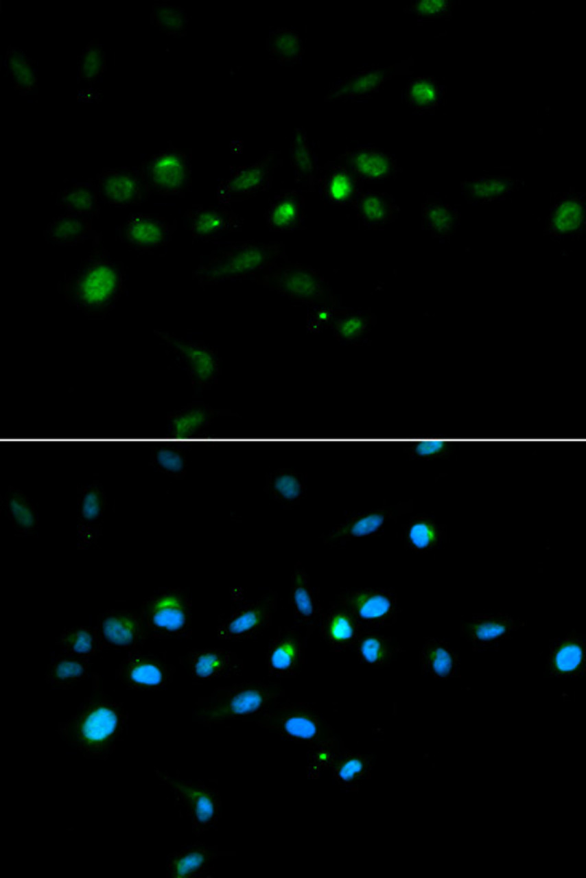 Immunofluorescence analysis of A549 cells using TRIM63 antibody (18-941) . Blue: DAPI for nuclear staining.