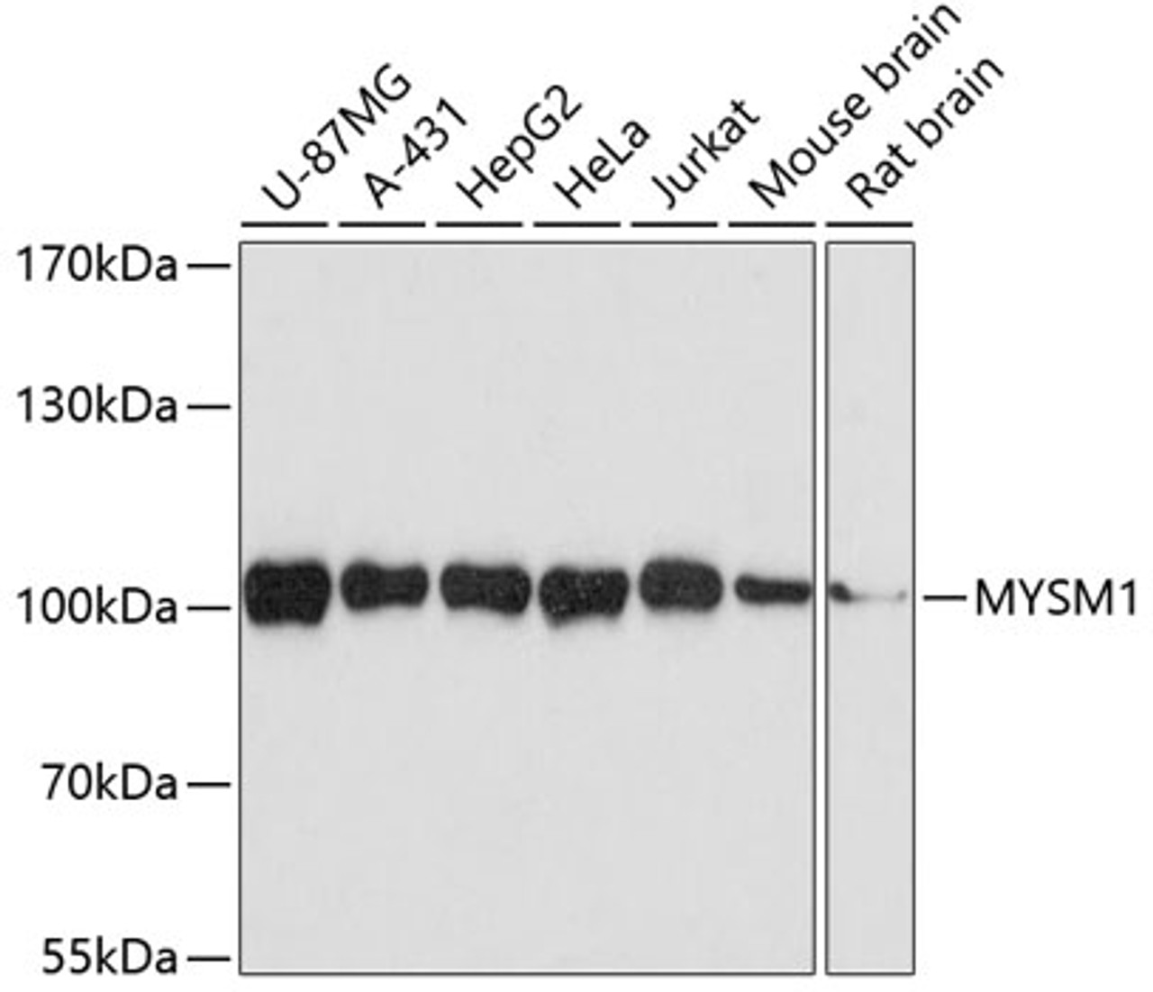 Western blot analysis of extracts of various cell lines, using MYSM1 antibody (18-942) at 1:3000 dilution.<br/>Secondary antibody: HRP Goat Anti-Rabbit IgG (H+L) at 1:10000 dilution.<br/>Lysates/proteins: 25ug per lane.<br/>Blocking buffer: 3% nonfat dry milk in TBST.<br/>Detection: ECL Basic Kit.<br/>Exposure time: 90s.