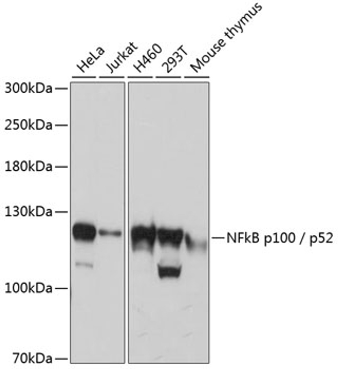 Western blot analysis of extracts of various cell lines, using NFkB p100 / p52 antibody (18-945) at 1:3000 dilution.<br/>Secondary antibody: HRP Goat Anti-Rabbit IgG (H+L) at 1:10000 dilution.<br/>Lysates/proteins: 25ug per lane.<br/>Blocking buffer: 3% nonfat dry milk in TBST.<br/>Detection: ECL Basic Kit.<br/>Exposure time: 30s.