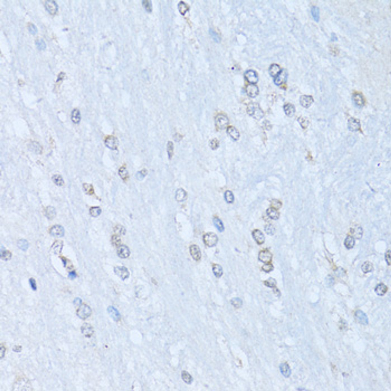 Immunohistochemistry of paraffin-embedded rat brain using NFkB p100 / p52 antibody (18-945) at dilution of 1:100 (40x lens) .