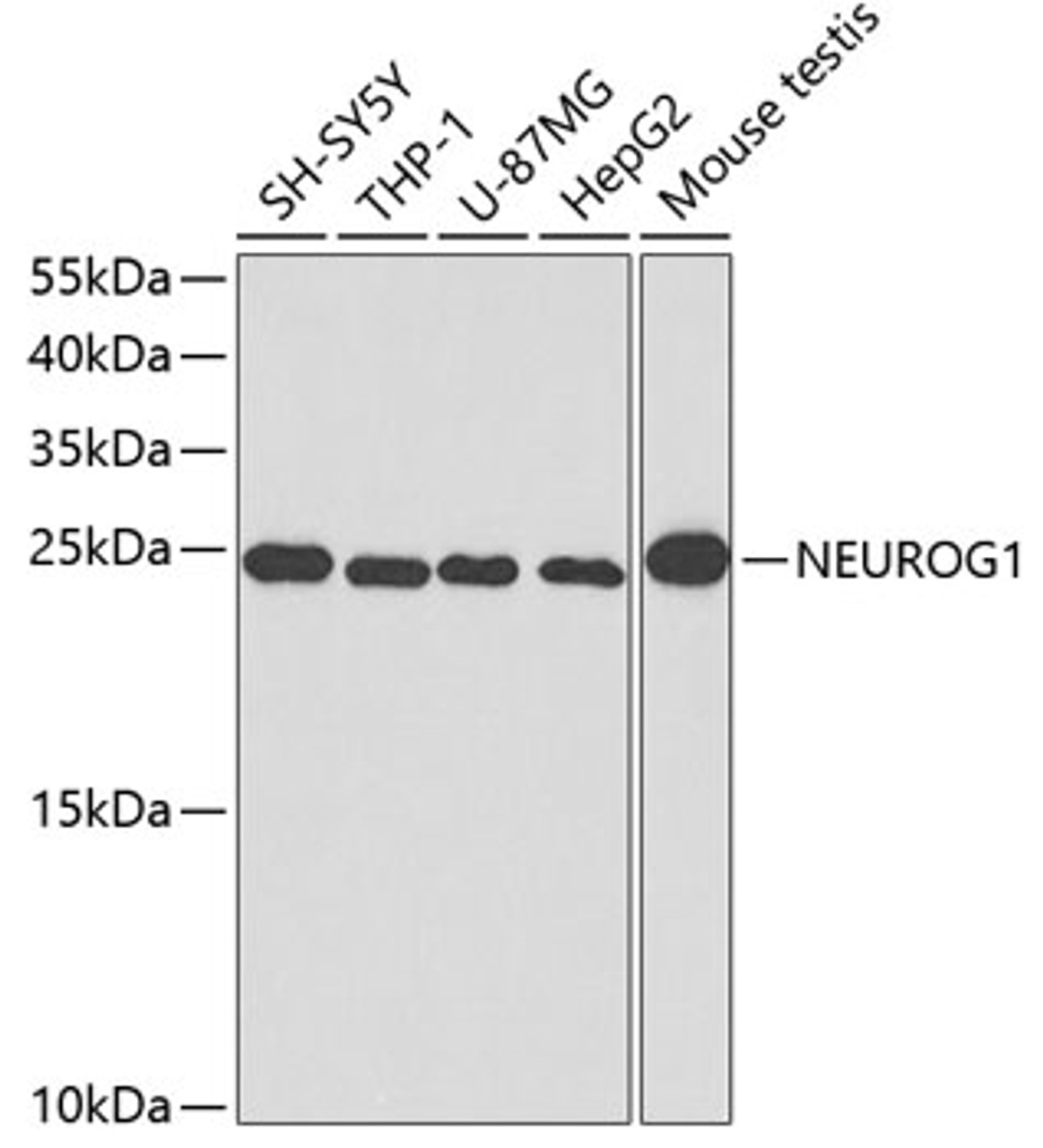 Western blot analysis of extracts of various cell lines, using NEUROG1 antibody (18-946) at 1:400 dilution.<br/>Secondary antibody: HRP Goat Anti-Rabbit IgG (H+L) at 1:10000 dilution.<br/>Lysates/proteins: 25ug per lane.<br/>Blocking buffer: 3% nonfat dry milk in TBST.
