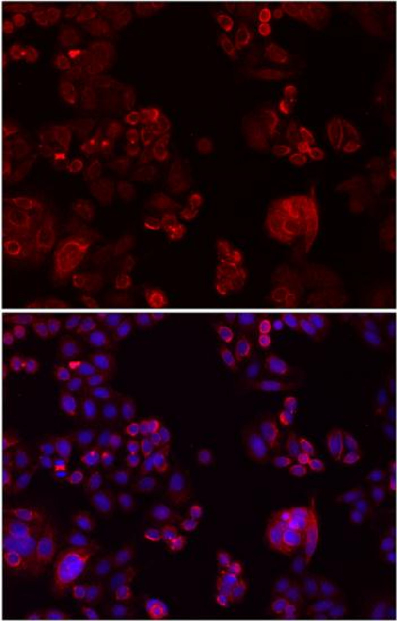 Immunofluorescence analysis of SW480 cells showing nuclear and cytoplasmic localization using NOTCH3 antibody (18-949) at dilution of 1:200 (top, red) .