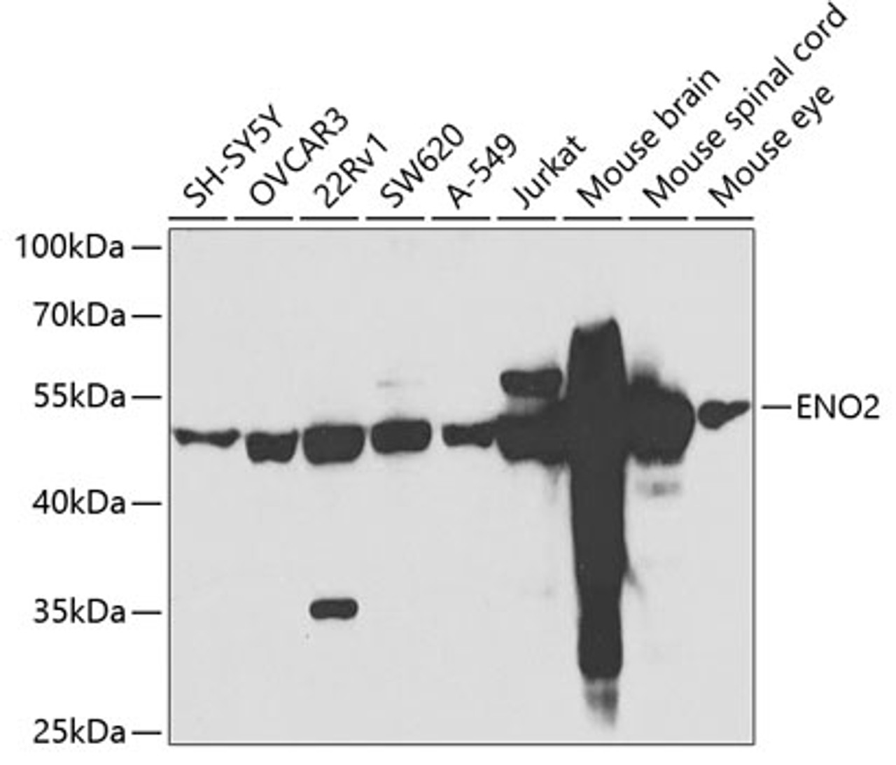 Western blot analysis of extracts of various cell lines, using ENO2 antibody (18-950) at 1:500 dilution._Secondary antibody: HRP Goat Anti-Rabbit IgG (H+L) at 1:10000 dilution._Lysates/proteins: 25ug per lane._Blocking buffer: 3% nonfat dry milk in TBST._Detection: ECL Basic Kit._Exposure time: 90S.