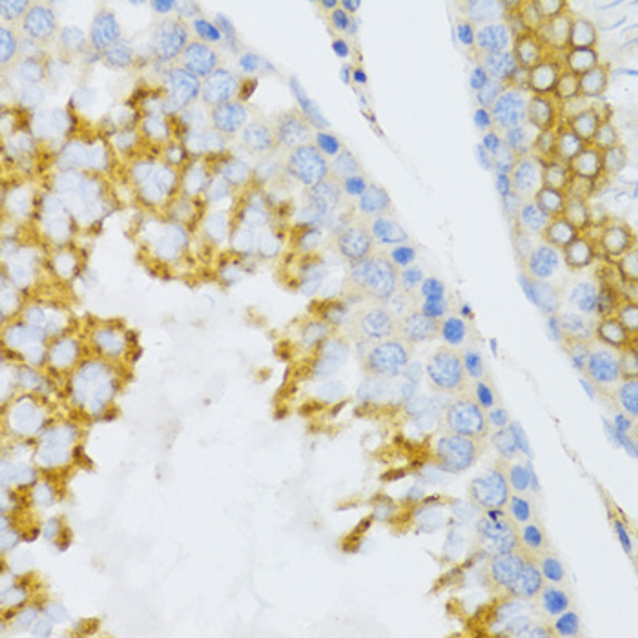Immunohistochemistry of paraffin-embedded mouse testis using PTN Antibody (18-953) at dilution of 1:100 (40x lens) .
