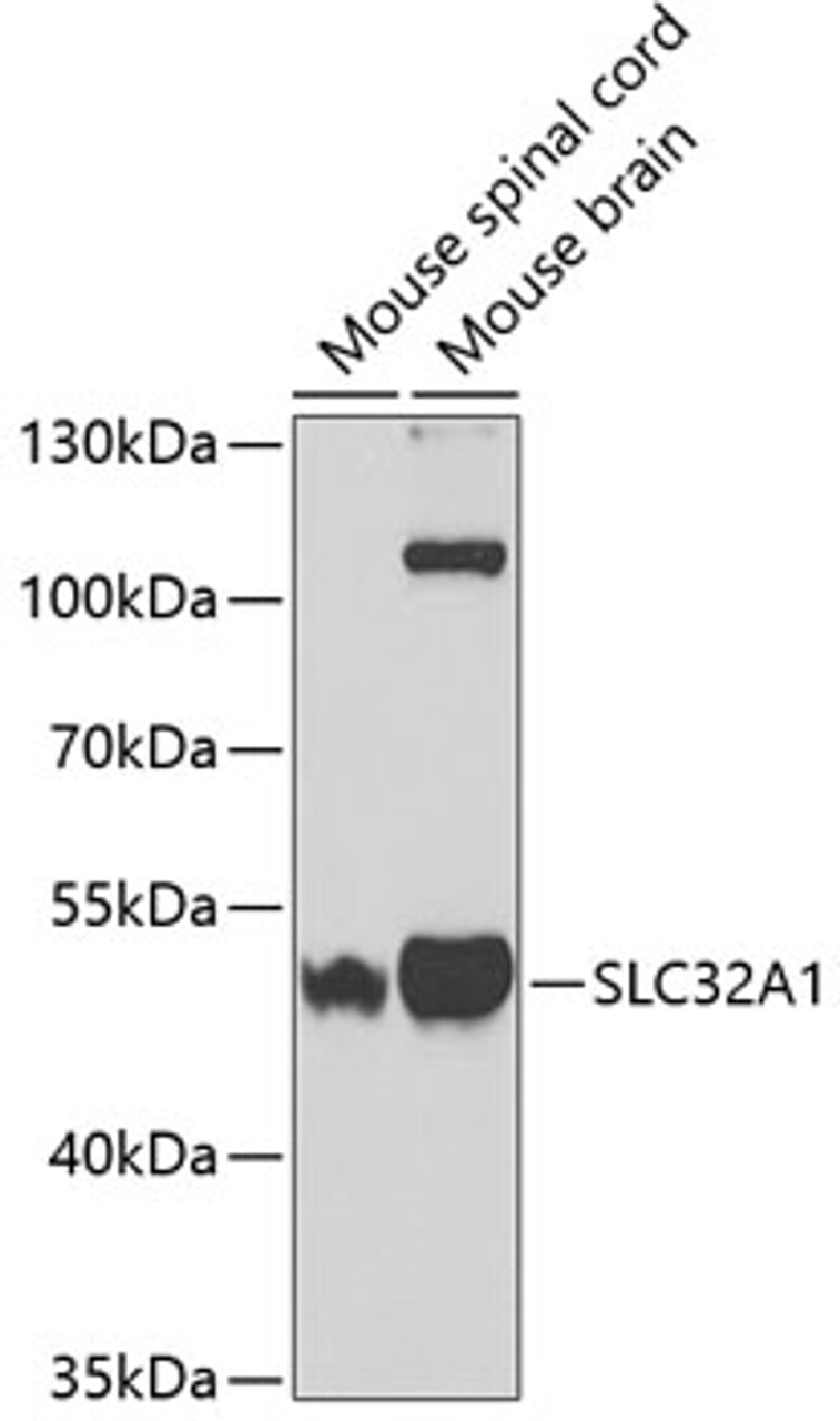 Western blot analysis of extracts of various cell lines, using SLC32A1 antibody (18-955) at 1:400 dilution.<br/>Secondary antibody: HRP Goat Anti-Rabbit IgG (H+L) at 1:10000 dilution.<br/>Lysates/proteins: 25ug per lane.<br/>Blocking buffer: 3% nonfat dry milk in TBST.