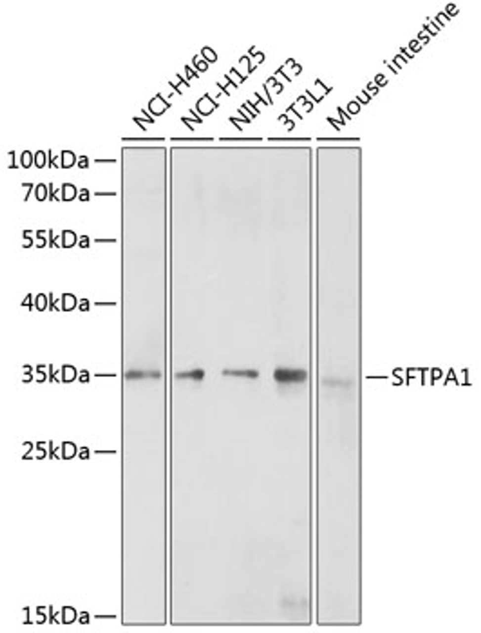 Western blot analysis of extracts of various cell lines, using SFTPA1 antibody (18-957) at 1:200 dilution.<br/>Secondary antibody: HRP Goat Anti-Rabbit IgG (H+L) at 1:10000 dilution.<br/>Lysates/proteins: 25ug per lane.<br/>Blocking buffer: 3% nonfat dry milk in TBST.<br/>Detection: ECL Enhanced Kit.<br/>Exposure time: 30s.