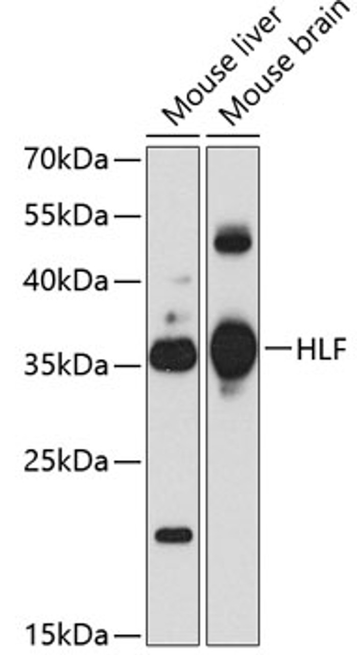 Western blot analysis of extracts of various cell lines, using HLF antibody (18-959) at 1:1000 dilution.<br/>Secondary antibody: HRP Goat Anti-Rabbit IgG (H+L) at 1:10000 dilution.<br/>Lysates/proteins: 25ug per lane.<br/>Blocking buffer: 3% nonfat dry milk in TBST.<br/>Detection: ECL Basic Kit.<br/>Exposure time: 90s.