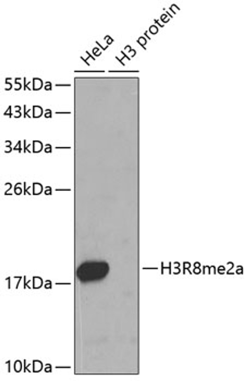 Western blot analysis of extracts of various cell lines, using Asymmetric DiMethyl-Histone H3-R8 antibody (18-969) .<br/>Secondary antibody: HRP Goat Anti-Rabbit IgG (H+L) at 1:10000 dilution.<br/>Lysates/proteins: 25ug per lane.<br/>Blocking buffer: 3% nonfat dry milk in TBST.