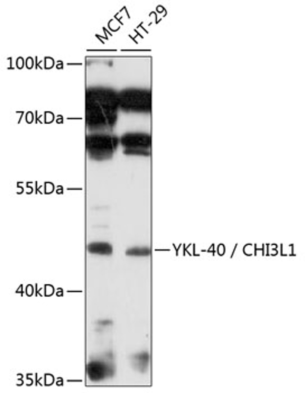 Western blot analysis of extracts of various cell lines, using YKL-40 / CHI3L1 antibody (18-974) at 1:1000 dilution.<br/>Secondary antibody: HRP Goat Anti-Rabbit IgG (H+L) at 1:10000 dilution.<br/>Lysates/proteins: 25ug per lane.<br/>Blocking buffer: 3% nonfat dry milk in TBST.<br/>Detection: ECL Basic Kit.<br/>Exposure time: 30s.