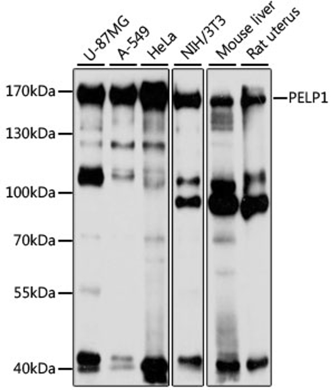 Western blot analysis of extracts of various cell lines, using PELP1 antibody (18-985) at 1:1000 dilution.<br/>Secondary antibody: HRP Goat Anti-Rabbit IgG (H+L) at 1:10000 dilution.<br/>Lysates/proteins: 25ug per lane.<br/>Blocking buffer: 3% nonfat dry milk in TBST.<br/>Detection: ECL Basic Kit.<br/>Exposure time: 10s.