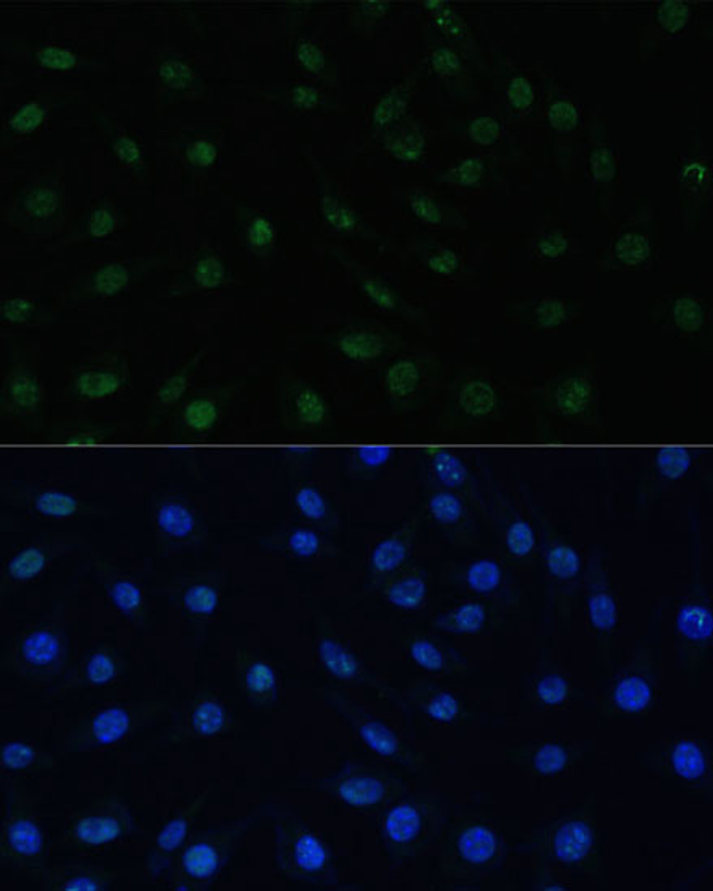 Immunofluorescence analysis of L929 cells using PELP1 Polyclonal Antibody (18-985) at dilution of 1:100 (40x lens) . Blue: DAPI for nuclear staining.