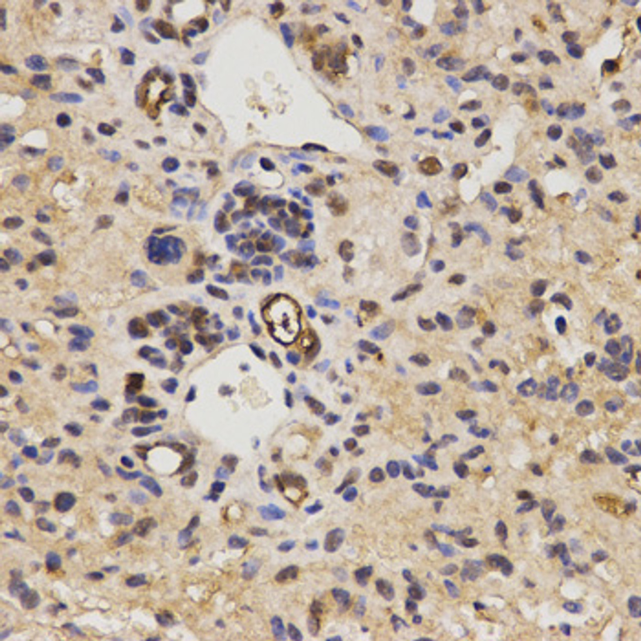 Immunohistochemistry of paraffin-embedded mouse liver fibrosis using FAM160B2 antibody (18-988) at dilution of 1:200 (40x lens) .