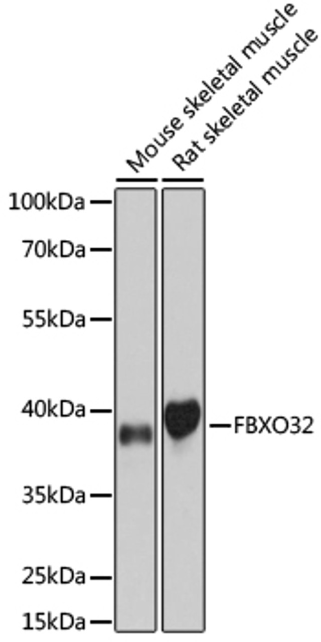Western blot analysis of extracts of various cell lines, using FBXO32 antibody (18-989) at dilution.<br/>Secondary antibody: HRP Goat Anti-Rabbit IgG (H+L) at 1:10000 dilution.<br/>Lysates/proteins: 25ug per lane.<br/>Blocking buffer: 3% nonfat dry milk in TBST.<br/>Detection: ECL Basic Kit.<br/>Exposure time: 15s.