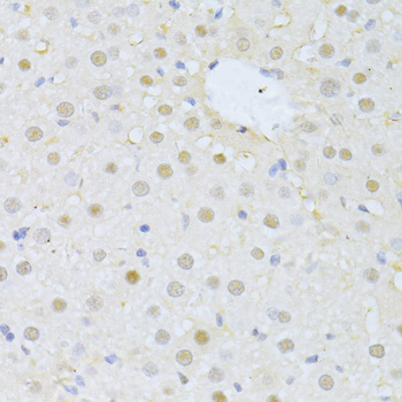Immunohistochemistry of paraffin-embedded rat liver using FBXO32 antibody (18-989) at dilution of 1:100 (40x lens) .