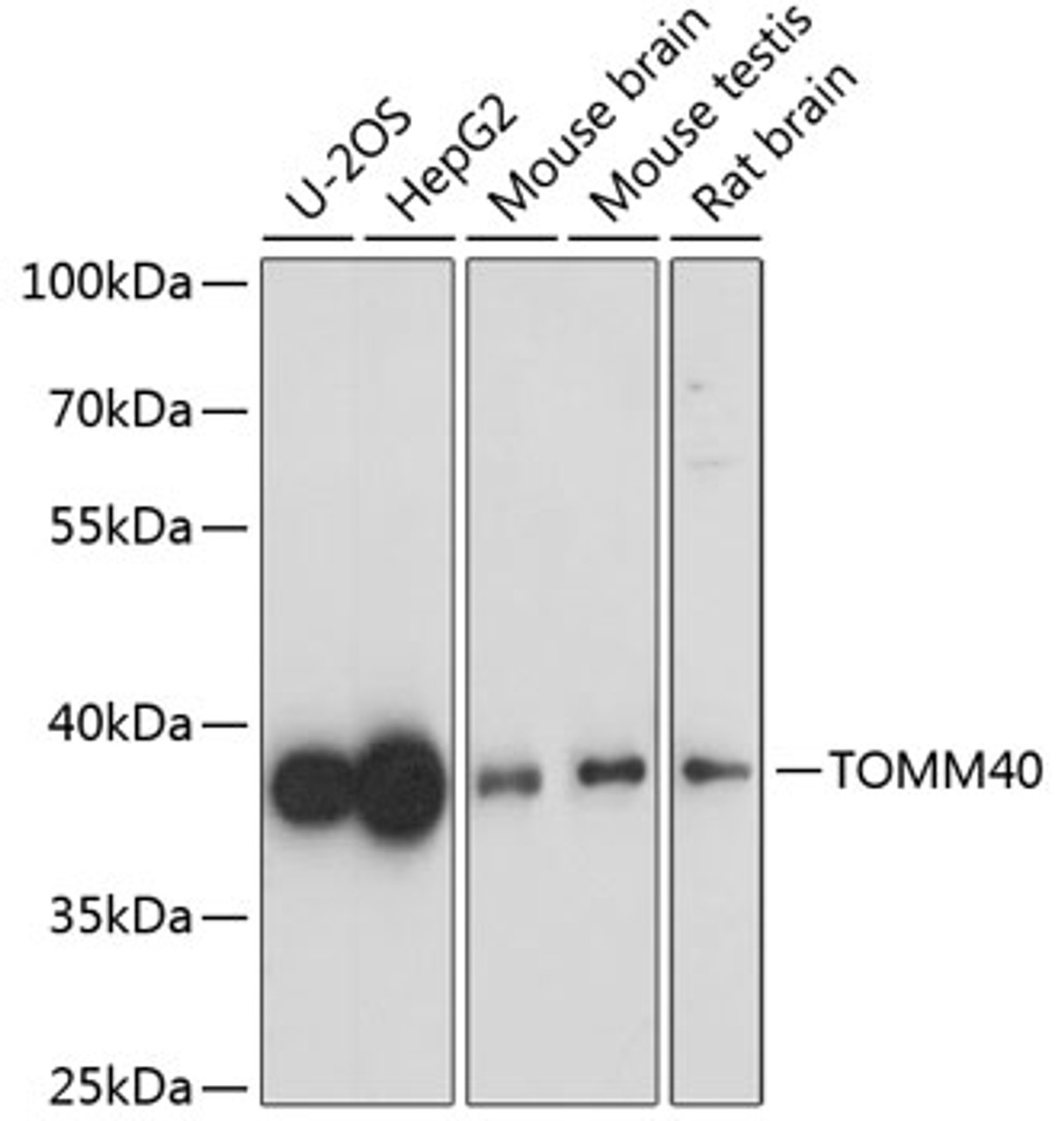 Western blot analysis of extracts of various cell lines, using TOMM40 antibody (18-997) at 1:1000 dilution.<br/>Secondary antibody: HRP Goat Anti-Rabbit IgG (H+L) at 1:10000 dilution.<br/>Lysates/proteins: 25ug per lane.<br/>Blocking buffer: 3% nonfat dry milk in TBST.<br/>Detection: ECL Basic Kit.<br/>Exposure time: 60s.
