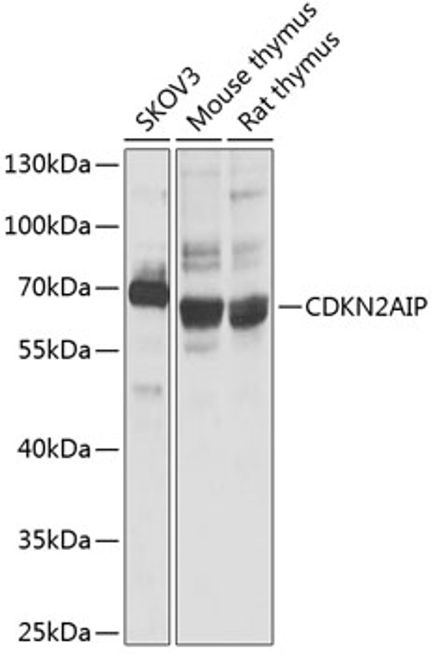 Western blot analysis of extracts of various cell lines, using CDKN2AIP antibody (19-003) at 1:1000 dilution.<br/>Secondary antibody: HRP Goat Anti-Rabbit IgG (H+L) at 1:10000 dilution.<br/>Lysates/proteins: 25ug per lane.<br/>Blocking buffer: 3% nonfat dry milk in TBST.<br/>Detection: ECL Basic Kit.<br/>Exposure time: 5s.