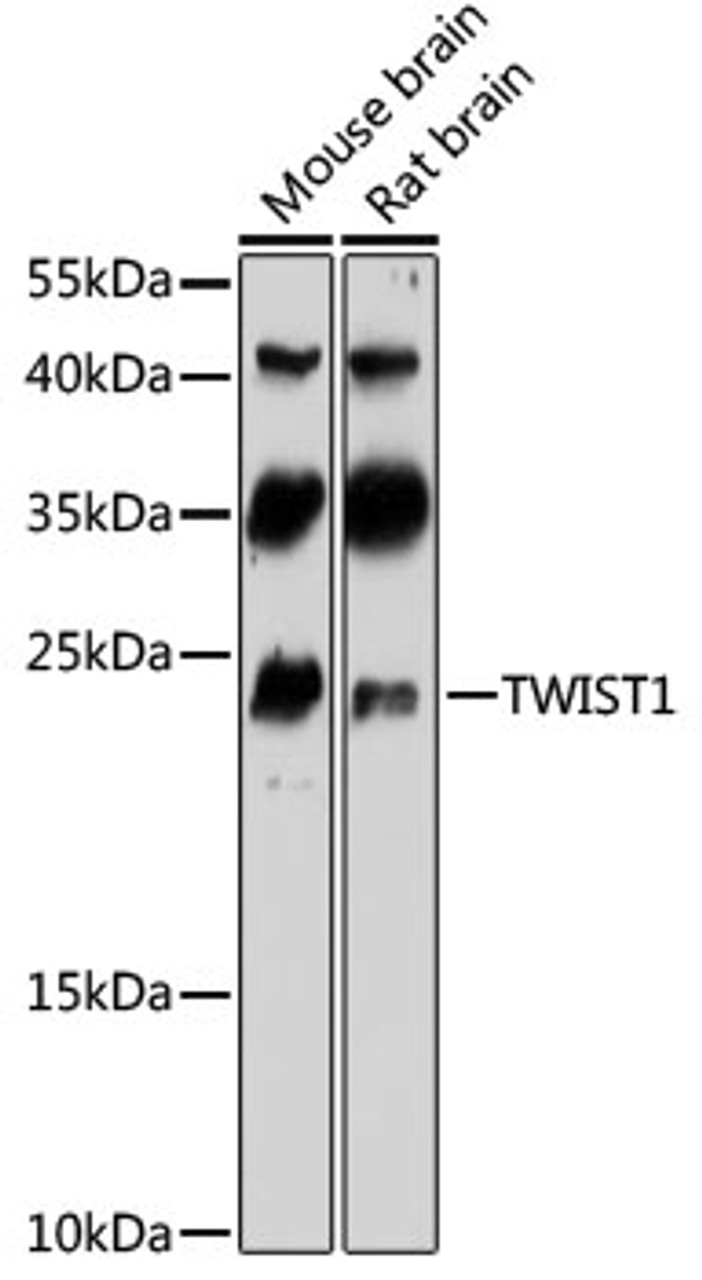 Western blot analysis of extracts of various cell lines, using TWIST1 antibody (19-004) at 1:1000 dilution.<br/>Secondary antibody: HRP Goat Anti-Rabbit IgG (H+L) at 1:10000 dilution.<br/>Lysates/proteins: 25ug per lane.<br/>Blocking buffer: 3% nonfat dry milk in TBST.<br/>Detection: ECL Basic Kit.<br/>Exposure time: 1min.