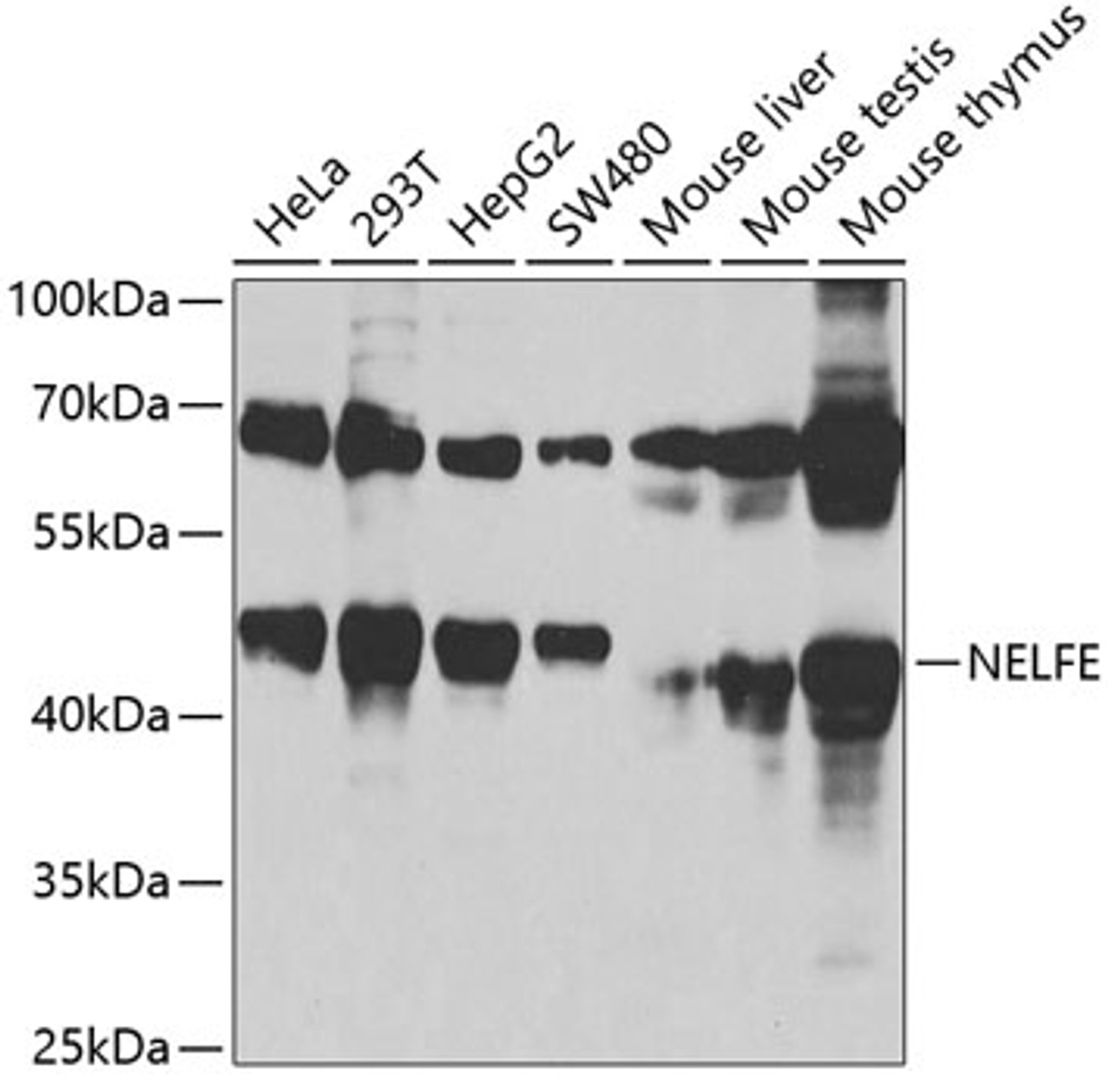 Western blot analysis of extracts of various cell lines, using NELFE antibody (19-008) at 1:1000 dilution.<br/>Secondary antibody: HRP Goat Anti-Rabbit IgG (H+L) at 1:10000 dilution.<br/>Lysates/proteins: 25ug per lane.<br/>Blocking buffer: 3% nonfat dry milk in TBST.<br/>Detection: ECL Basic Kit.<br/>Exposure time: 90s.