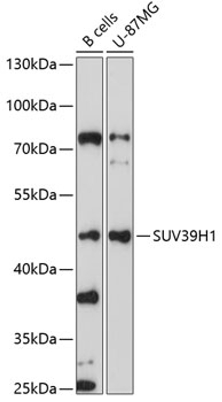 Western blot analysis of extracts of various cell lines, using SUV39H1 antibody (19-014) at 1:1000 dilution.<br/>Secondary antibody: HRP Goat Anti-Rabbit IgG (H+L) at 1:10000 dilution.<br/>Lysates/proteins: 25ug per lane.<br/>Blocking buffer: 3% nonfat dry milk in TBST.<br/>Detection: ECL Basic Kit.<br/>Exposure time: 30s.