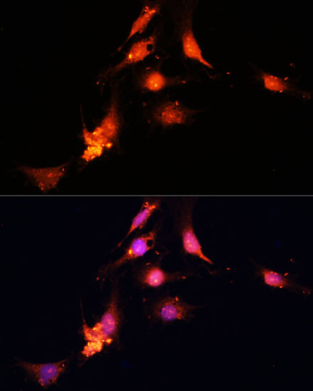 Immunofluorescence analysis of C6 cells using SUV39H1 Polyclonal Antibody (19-014) at dilution of 1:100 (40x lens) . Blue: DAPI for nuclear staining.