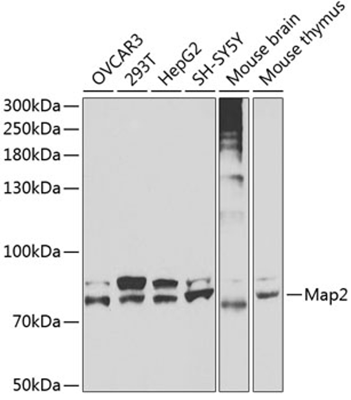 Western blot analysis of extracts of various cell lines, using Map2 antibody (19-015) at 1:400 dilution.<br/>Secondary antibody: HRP Goat Anti-Rabbit IgG (H+L) at 1:10000 dilution.<br/>Lysates/proteins: 25ug per lane.<br/>Blocking buffer: 3% nonfat dry milk in TBST.<br/>Detection: ECL Basic Kit.<br/>Exposure time: 30s.
