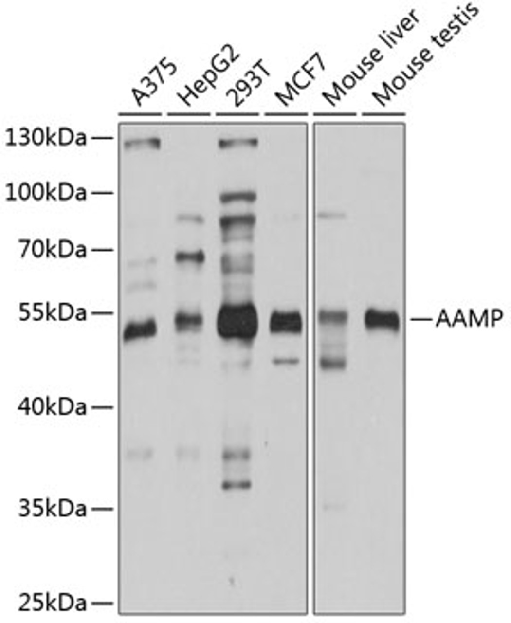 Western blot analysis of extracts of various cell lines, using AAMP antibody (19-018) at 1:1000 dilution.<br/>Secondary antibody: HRP Goat Anti-Rabbit IgG (H+L) at 1:10000 dilution.<br/>Lysates/proteins: 25ug per lane.<br/>Blocking buffer: 3% nonfat dry milk in TBST.<br/>Detection: ECL Basic Kit.<br/>Exposure time: 30s.