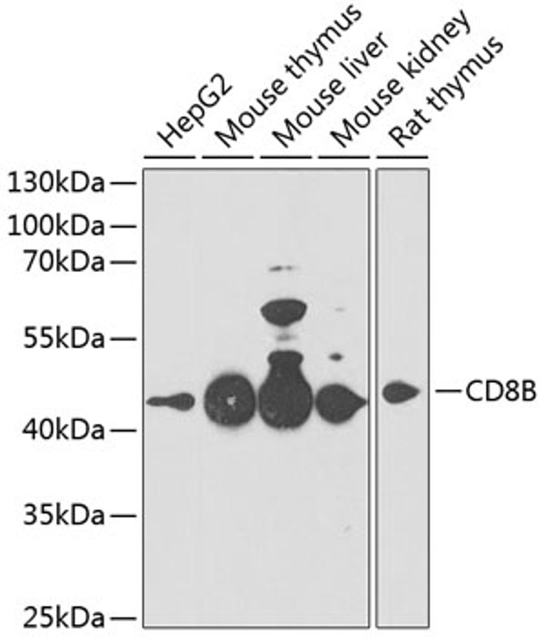 Western blot analysis of extracts of various cell lines, using CD8B antibody (19-020) at 1:1000 dilution.<br/>Secondary antibody: HRP Goat Anti-Rabbit IgG (H+L) at 1:10000 dilution.<br/>Lysates/proteins: 25ug per lane.<br/>Blocking buffer: 3% nonfat dry milk in TBST.<br/>Detection: ECL Enhanced Kit.<br/>Exposure time: 90s.