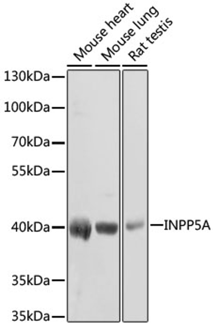 Western blot analysis of extracts of various cell lines, using INPP5A antibody (19-027) at 1:1000 dilution.<br/>Secondary antibody: HRP Goat Anti-Rabbit IgG (H+L) at 1:10000 dilution.<br/>Lysates/proteins: 25ug per lane.<br/>Blocking buffer: 3% nonfat dry milk in TBST.<br/>Detection: ECL Basic Kit.<br/>Exposure time: 30s.