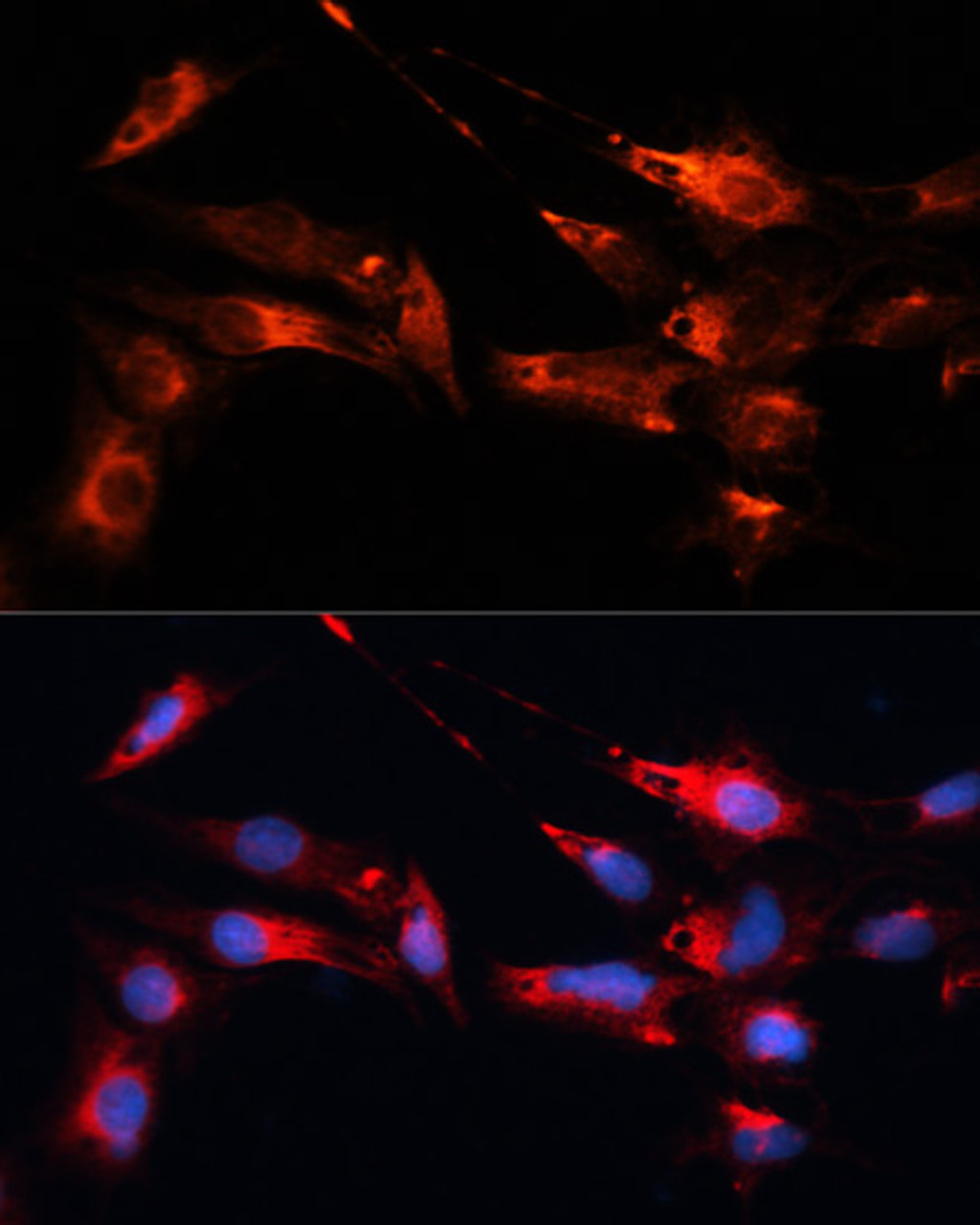 Immunofluorescence analysis of C6 cells using MAP1B antibody (19-029) at dilution of 1:100. Blue: DAPI for nuclear staining.