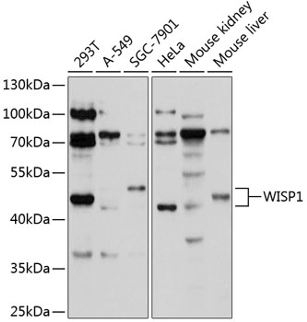 Western blot analysis of extracts of various cell lines, using WISP1 antibody (19-040) at 1:1000 dilution.<br/>Secondary antibody: HRP Goat Anti-Rabbit IgG (H+L) at 1:10000 dilution.<br/>Lysates/proteins: 25ug per lane.<br/>Blocking buffer: 3% nonfat dry milk in TBST.<br/>Detection: ECL Basic Kit.<br/>Exposure time: 15s.