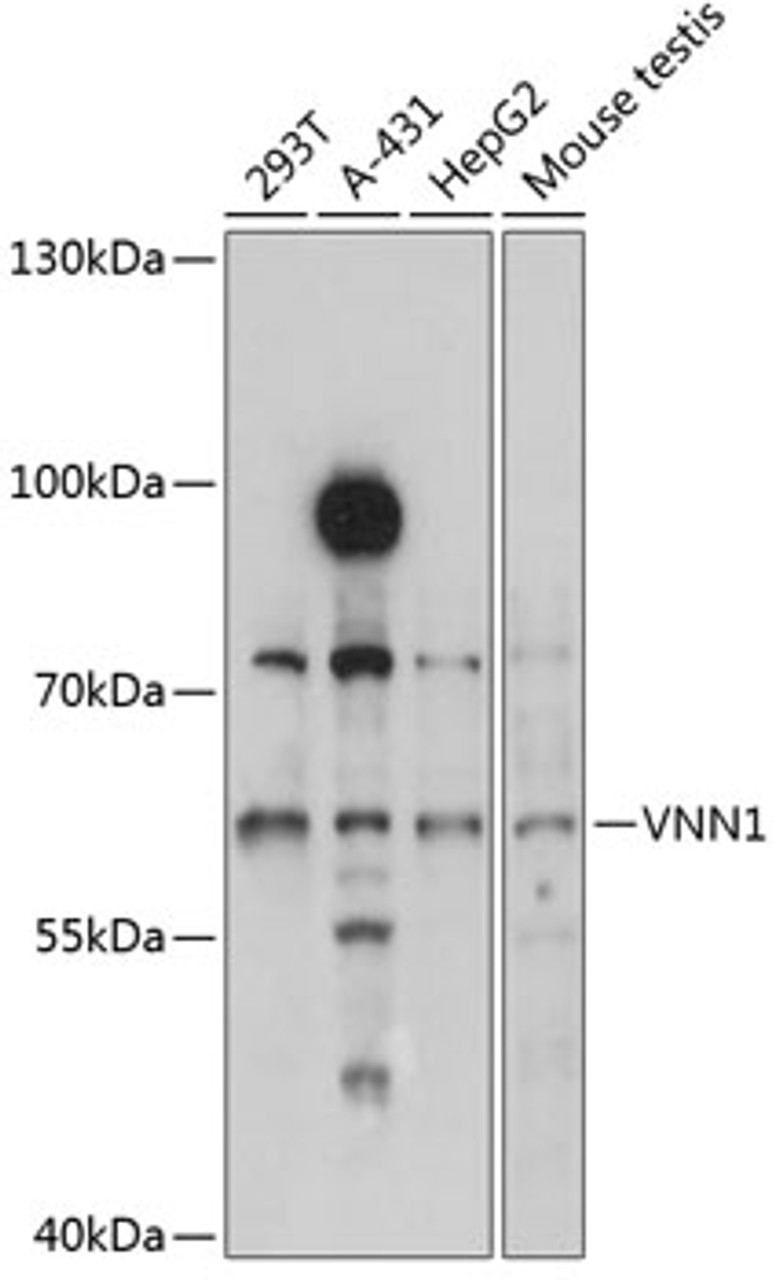 Western blot analysis of extracts of various cell lines, using VNN1 antibody (19-041) at 1:3000 dilution.<br/>Secondary antibody: HRP Goat Anti-Rabbit IgG (H+L) at 1:10000 dilution.<br/>Lysates/proteins: 25ug per lane.<br/>Blocking buffer: 3% nonfat dry milk in TBST.<br/>Detection: ECL Basic Kit.<br/>Exposure time: 5s.
