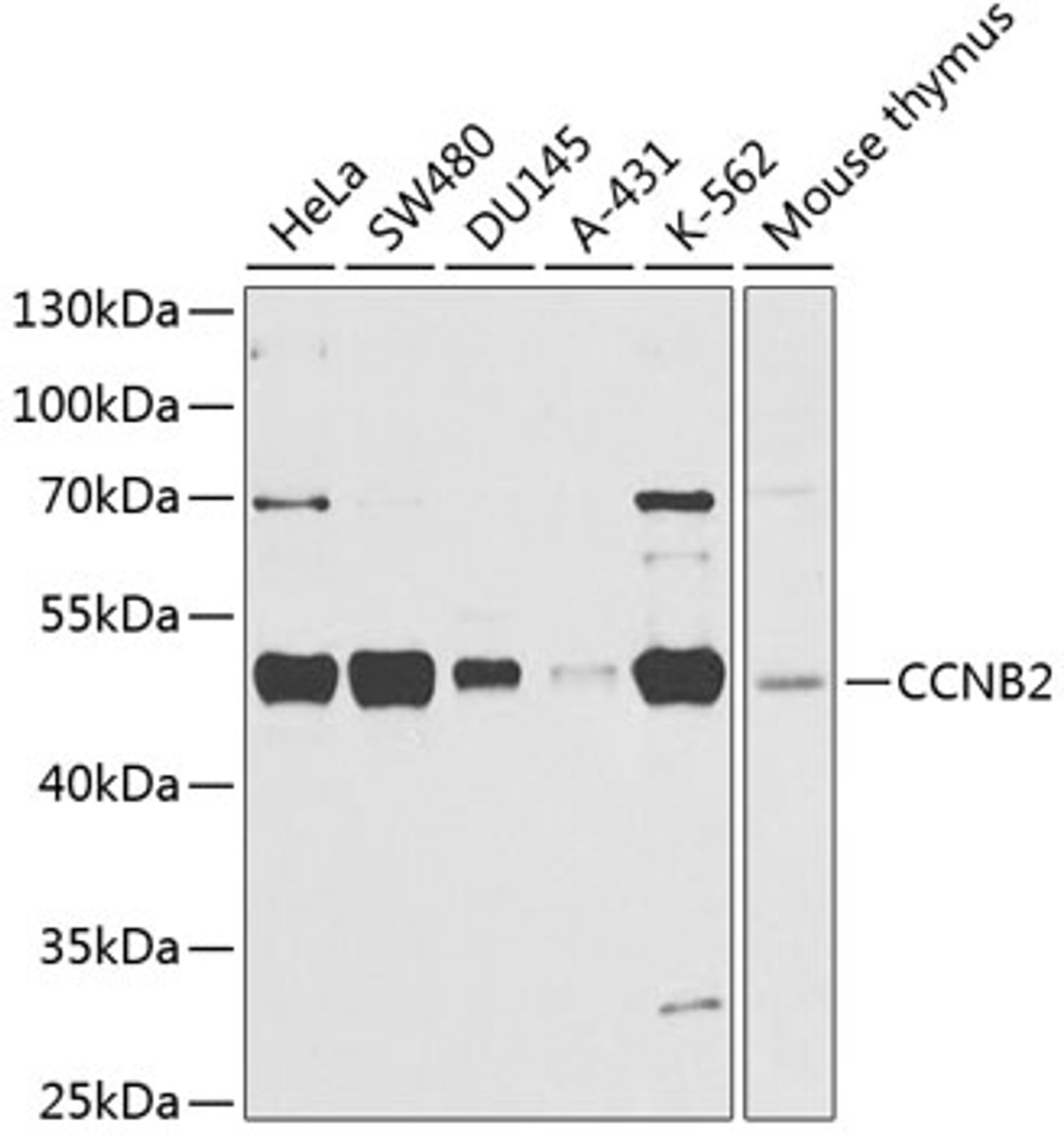 Western blot analysis of extracts of various cell lines, using CCNB2 antibody (19-043) at 1:1000 dilution.<br/>Secondary antibody: HRP Goat Anti-Rabbit IgG (H+L) at 1:10000 dilution.<br/>Lysates/proteins: 25ug per lane.<br/>Blocking buffer: 3% nonfat dry milk in TBST.<br/>Detection: ECL Basic Kit.<br/>Exposure time: 30s.