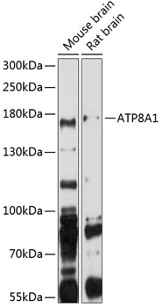 Western blot analysis of extracts of various cell lines, using ATP8A1 antibody (19-049) at 1:1000 dilution.<br/>Secondary antibody: HRP Goat Anti-Rabbit IgG (H+L) at 1:10000 dilution.<br/>Lysates/proteins: 25ug per lane.<br/>Blocking buffer: 3% nonfat dry milk in TBST.<br/>Detection: ECL Basic Kit.<br/>Exposure time: 90s.