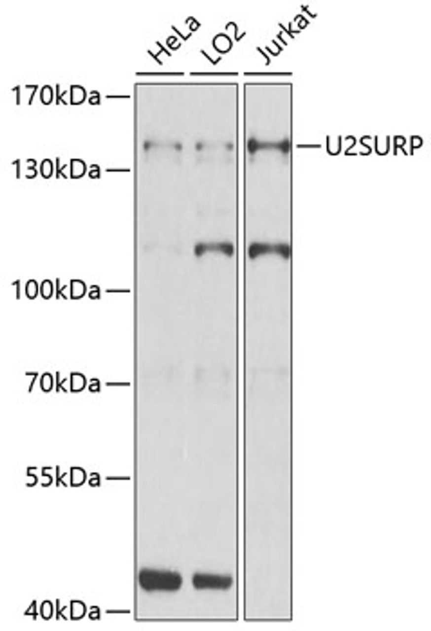 Western blot analysis of extracts of various cell lines, using U2SURP Antibody (19-055) at 1:1000 dilution.<br/>Secondary antibody: HRP Goat Anti-Rabbit IgG (H+L) at 1:10000 dilution.<br/>Lysates/proteins: 25ug per lane.<br/>Blocking buffer: 3% nonfat dry milk in TBST.<br/>Detection: ECL Basic Kit.<br/>Exposure time: 15s.