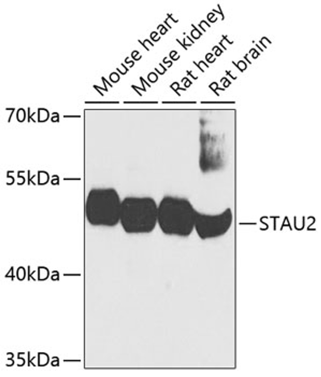 Western blot analysis of extracts of various cell lines, using STAU2 antibody (19-060) at 1:1000 dilution.<br/>Secondary antibody: HRP Goat Anti-Rabbit IgG (H+L) at 1:10000 dilution.<br/>Lysates/proteins: 25ug per lane.<br/>Blocking buffer: 3% nonfat dry milk in TBST.<br/>Detection: ECL Basic Kit.<br/>Exposure time: 30s.