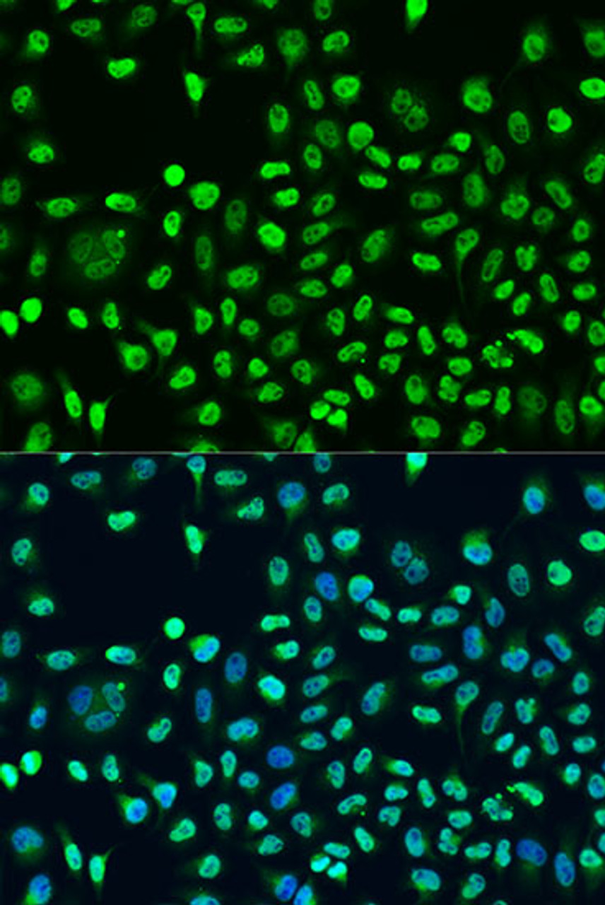 Immunofluorescence analysis of U2OS cells using STAU2 antibody (19-060) at dilution of 1:100. Blue: DAPI for nuclear staining.