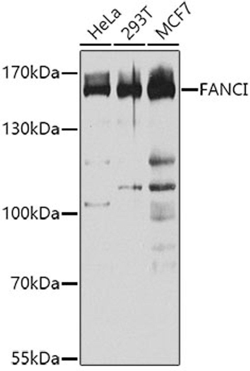 Western blot analysis of extracts of various cell lines, using FANCI antibody (19-070) at 1:1000 dilution.<br/>Secondary antibody: HRP Goat Anti-Rabbit IgG (H+L) at 1:10000 dilution.<br/>Lysates/proteins: 25ug per lane.<br/>Blocking buffer: 3% nonfat dry milk in TBST.<br/>Detection: ECL Basic Kit.<br/>Exposure time: 10s.