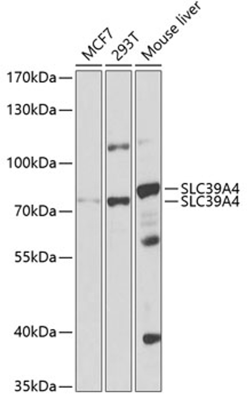 Western blot analysis of extracts of various cell lines, using SLC39A4 antibody (19-072) at 1:1000 dilution.<br/>Secondary antibody: HRP Goat Anti-Rabbit IgG (H+L) at 1:10000 dilution.<br/>Lysates/proteins: 25ug per lane.<br/>Blocking buffer: 3% nonfat dry milk in TBST.<br/>Detection: ECL Basic Kit.<br/>Exposure time: 90s.