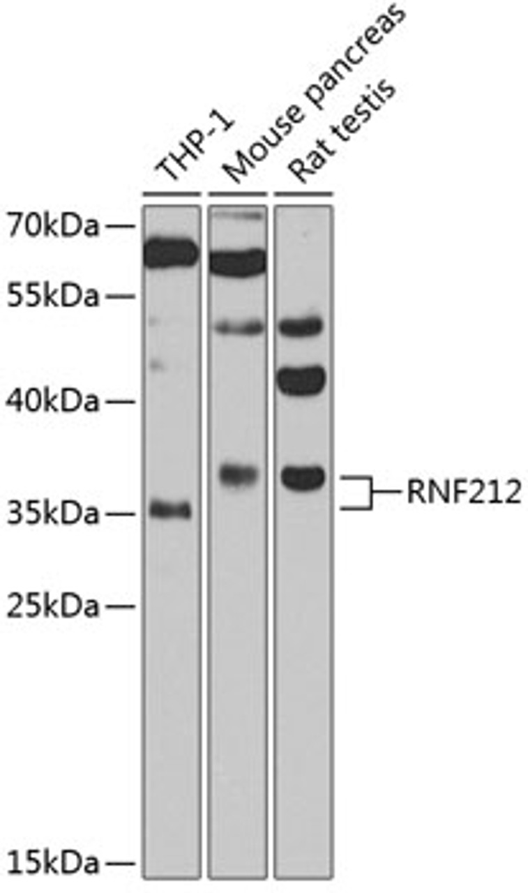 Western blot analysis of extracts of various cell lines, using RNF212 antibody (19-091) at 1:1000 dilution.<br/>Secondary antibody: HRP Goat Anti-Rabbit IgG (H+L) at 1:10000 dilution.<br/>Lysates/proteins: 25ug per lane.<br/>Blocking buffer: 3% nonfat dry milk in TBST.<br/>Detection: ECL Basic Kit.<br/>Exposure time: 90s.