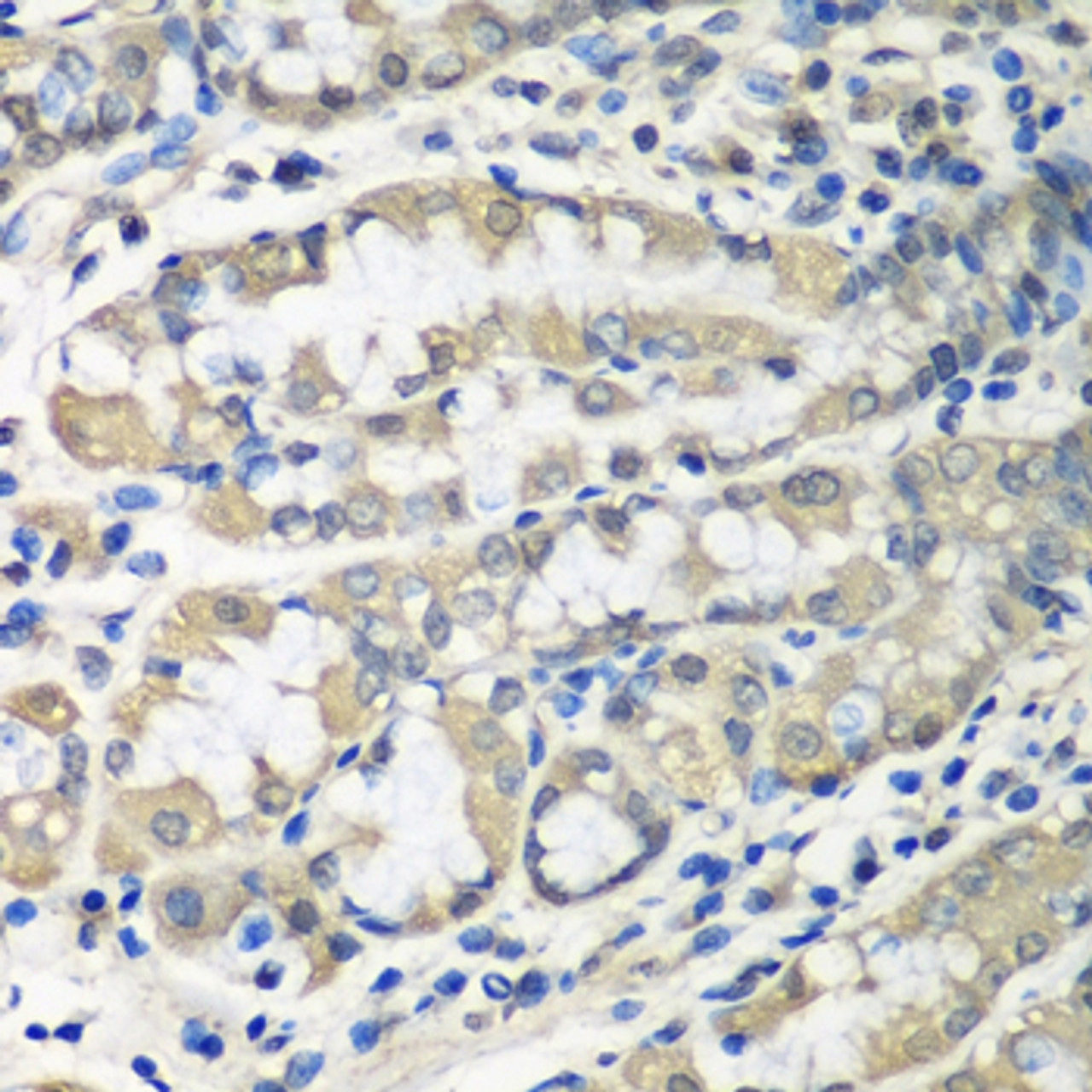 Immunohistochemistry of paraffin-embedded human stomach using CCT6A antibody (19-097) at dilution of 1:100 (40x lens) .