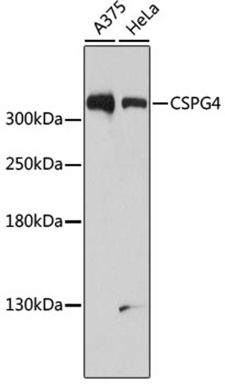 Western blot analysis of extracts of various cell lines, using CSPG4 antibody (19-098) at 1:1000 dilution.<br/>Secondary antibody: HRP Goat Anti-Rabbit IgG (H+L) at 1:10000 dilution.<br/>Lysates/proteins: 25ug per lane.<br/>Blocking buffer: 3% nonfat dry milk in TBST.<br/>Detection: ECL Basic Kit.<br/>Exposure time: 90s.