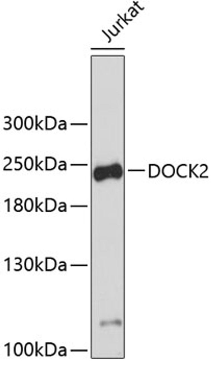 Western blot analysis of extracts of Jurkat cells, using DOCK2 antibody (19-099) .<br/>Secondary antibody: HRP Goat Anti-Rabbit IgG (H+L) at 1:10000 dilution.<br/>Lysates/proteins: 25ug per lane.<br/>Blocking buffer: 3% nonfat dry milk in TBST.