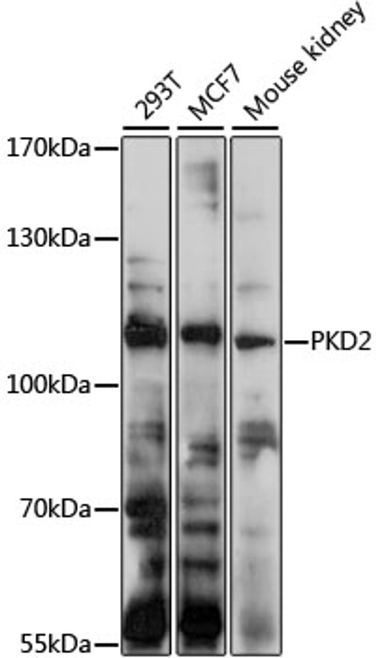 Western blot analysis of extracts of various cell lines, using PKD2 antibody (19-107) at 1:1000 dilution.<br/>Secondary antibody: HRP Goat Anti-Rabbit IgG (H+L) at 1:10000 dilution.<br/>Lysates/proteins: 25ug per lane.<br/>Blocking buffer: 3% nonfat dry milk in TBST.<br/>Detection: ECL Basic Kit.<br/>Exposure time: 30s.