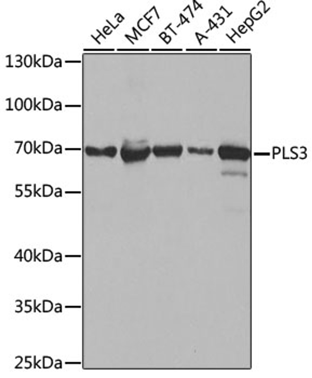 Western blot analysis of extracts of various cell lines, using PLS3 antibody (19-108) at 1:1000 dilution.<br/>Secondary antibody: HRP Goat Anti-Rabbit IgG (H+L) at 1:10000 dilution.<br/>Lysates/proteins: 25ug per lane.<br/>Blocking buffer: 3% nonfat dry milk in TBST.<br/>Detection: ECL Basic Kit.<br/>Exposure time: 10s.