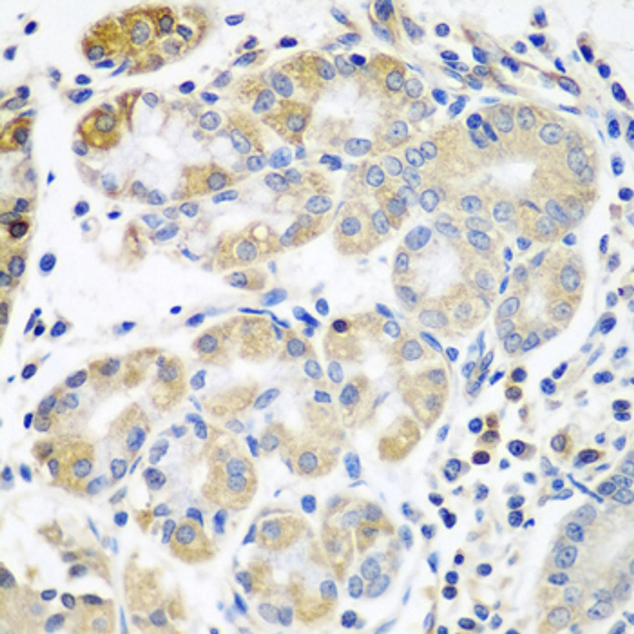 Immunohistochemistry of paraffin-embedded human stomach using PLS3 antibody (19-108) at dilution of 1:100 (40x lens) .