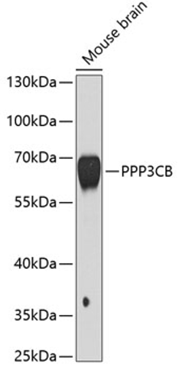 Western blot analysis of extracts of mouse brain, using PPP3CB antibody (19-109) at 1:1000 dilution.<br/>Secondary antibody: HRP Goat Anti-Rabbit IgG (H+L) at 1:10000 dilution.<br/>Lysates/proteins: 25ug per lane.<br/>Blocking buffer: 3% nonfat dry milk in TBST.<br/>Detection: ECL Basic Kit.<br/>Exposure time: 5s.