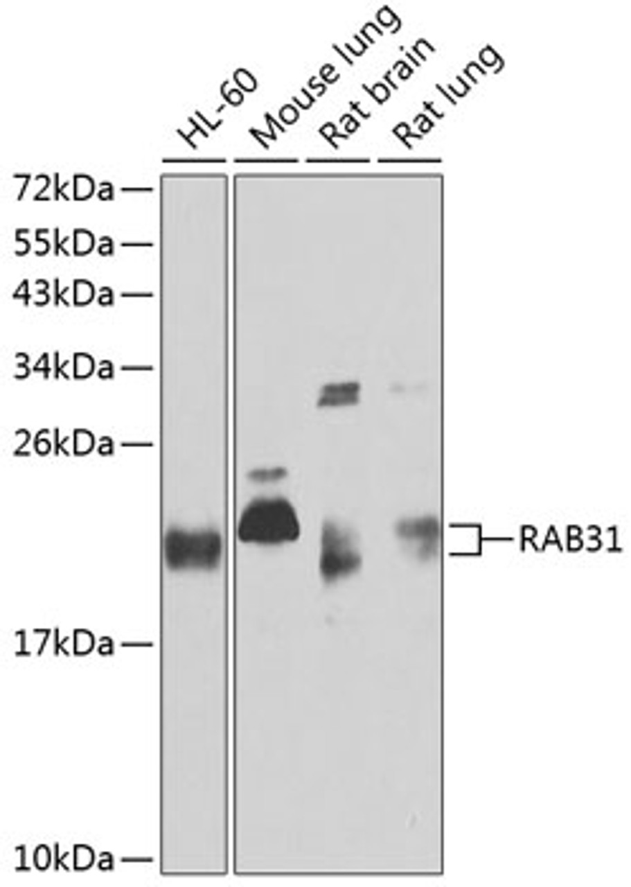 Western blot analysis of extracts of various cell lines, using RAB31 antibody (19-126) at 1:1000 dilution.<br/>Secondary antibody: HRP Goat Anti-Rabbit IgG (H+L) at 1:10000 dilution.<br/>Lysates/proteins: 25ug per lane.<br/>Blocking buffer: 3% nonfat dry milk in TBST.<br/>Detection: ECL Basic Kit.<br/>Exposure time: 30s.