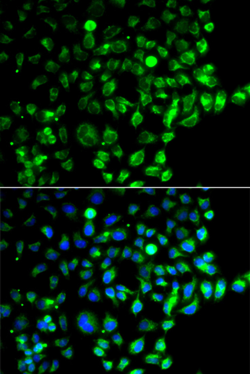 Immunofluorescence analysis of A549 cells using RAB31 antibody (19-126) . Blue: DAPI for nuclear staining.