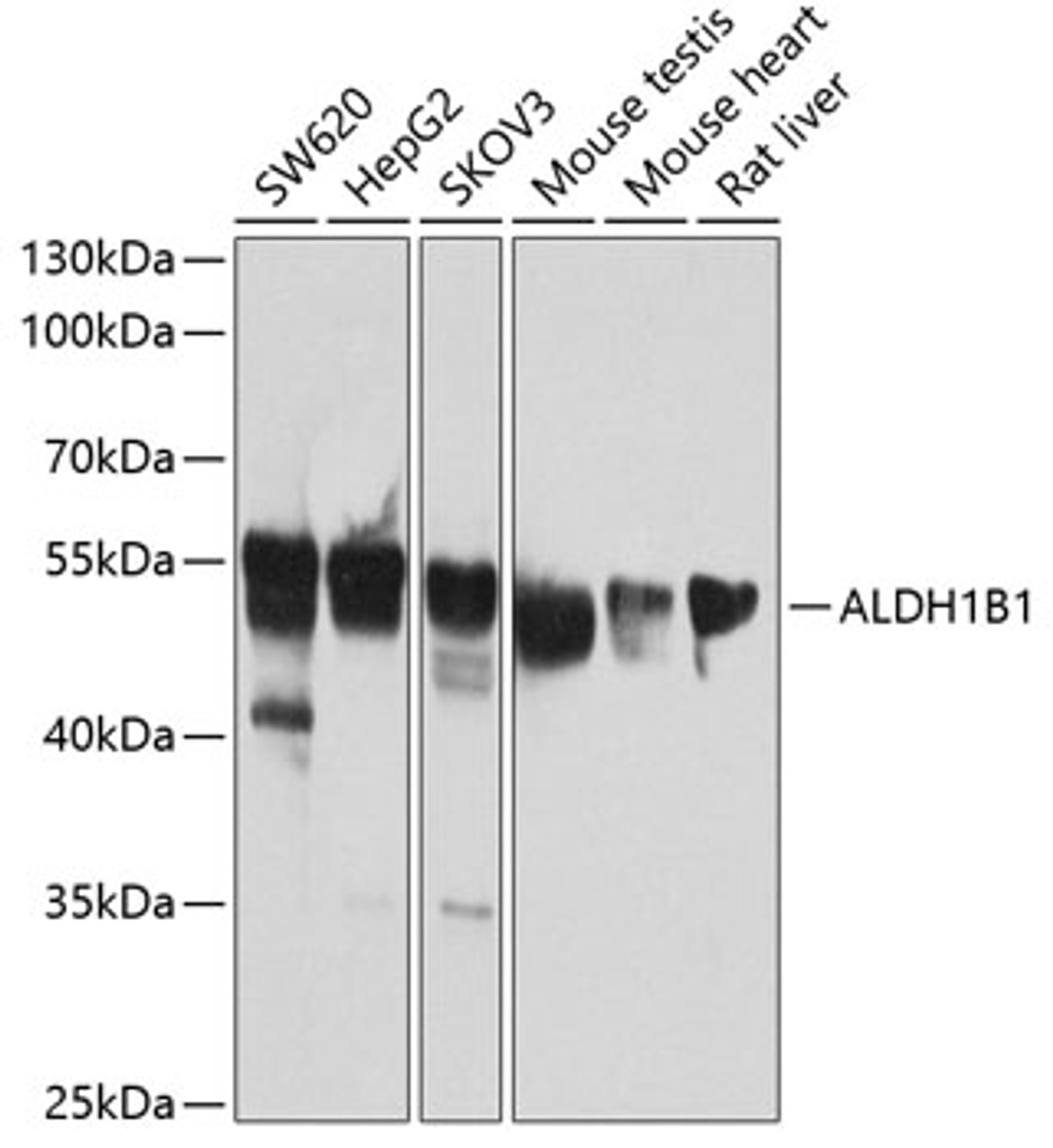 Western blot analysis of extracts of various cell lines, using ALDH1B1 antibody (19-135) at 1:1000 dilution.<br/>Secondary antibody: HRP Goat Anti-Rabbit IgG (H+L) at 1:10000 dilution.<br/>Lysates/proteins: 25ug per lane.<br/>Blocking buffer: 3% nonfat dry milk in TBST.<br/>Detection: ECL Basic Kit.<br/>Exposure time: 30s.